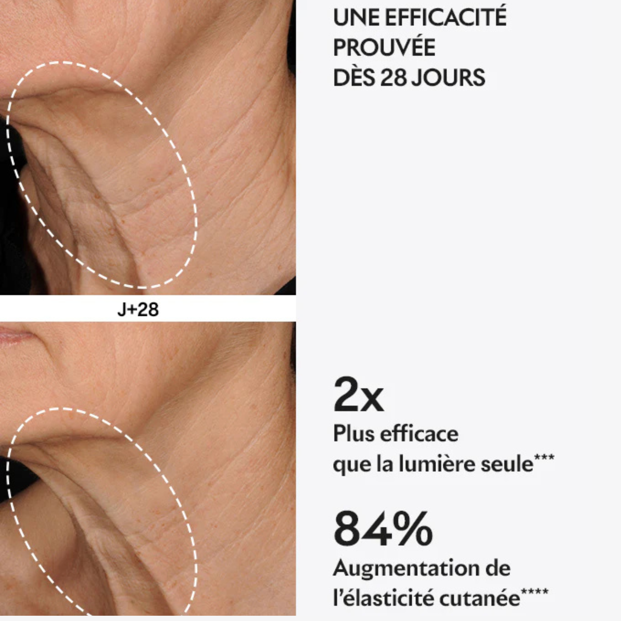 Capsules Lift - Peaux en manque de fermeté