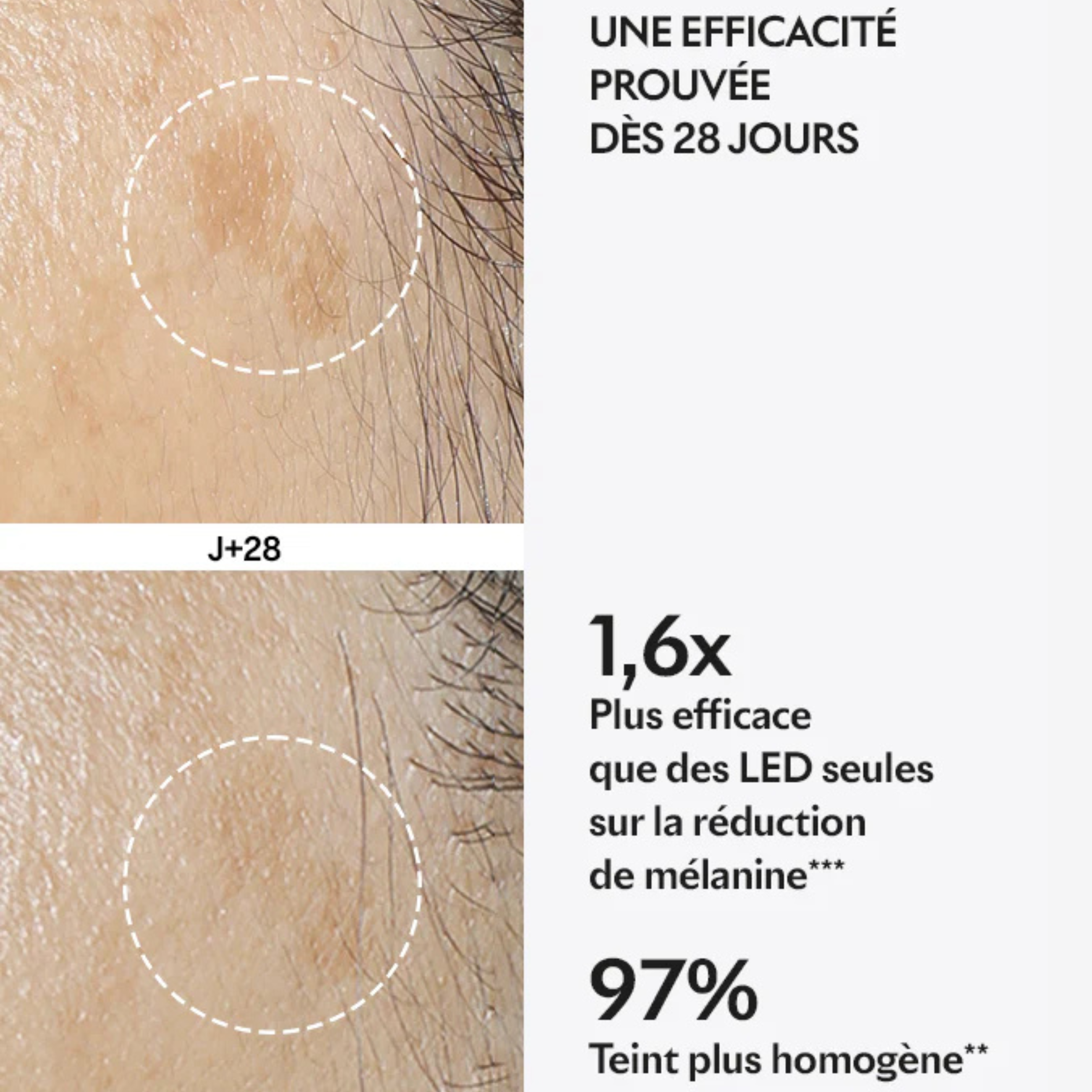 Capsules Spotless - Taches pigmentaires