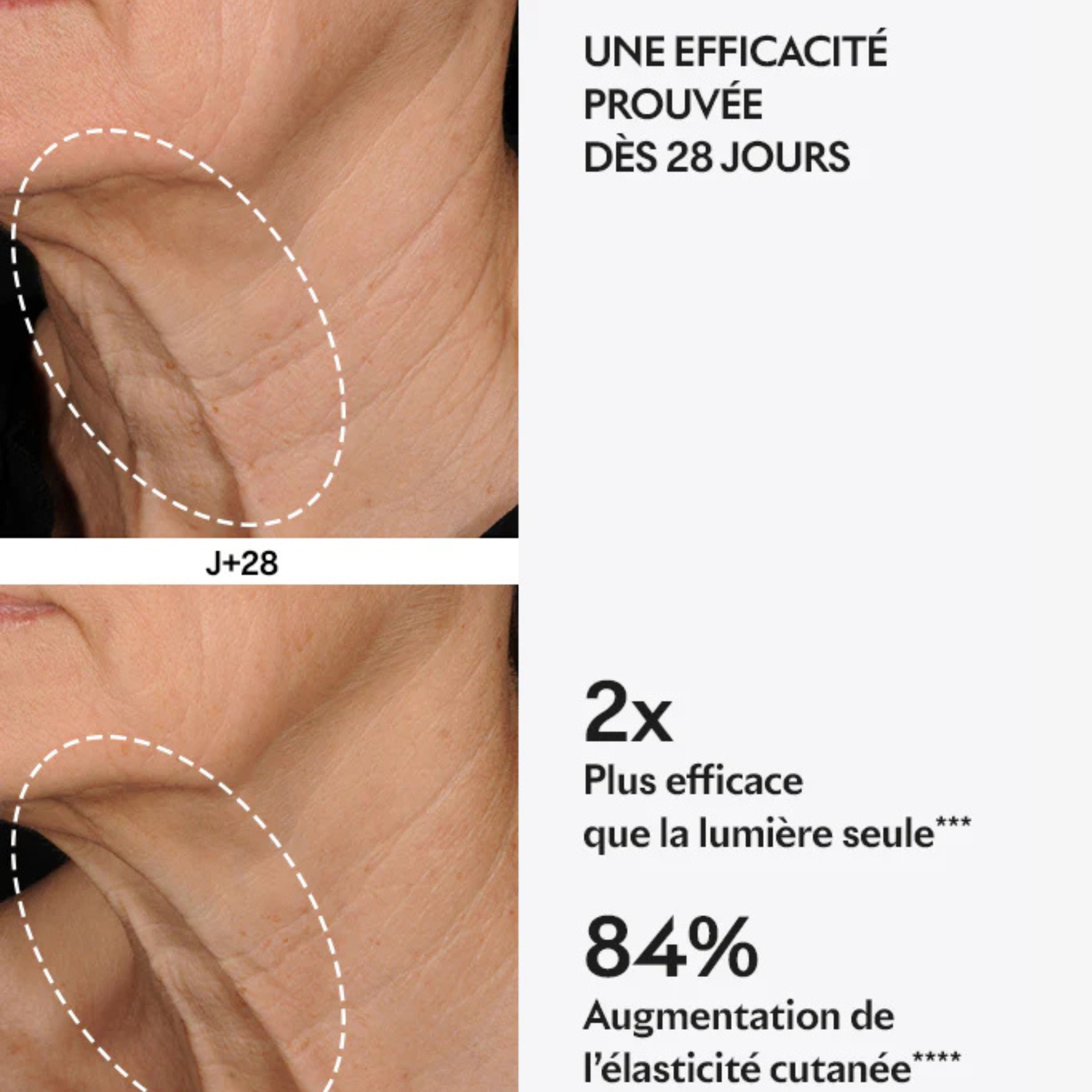 Grande trousse capsules LIFT