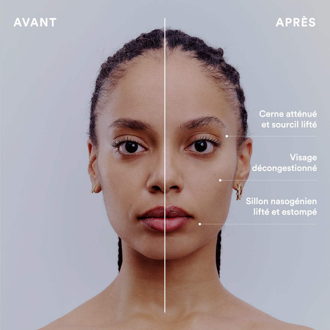 Brosse Lymphatique Visage