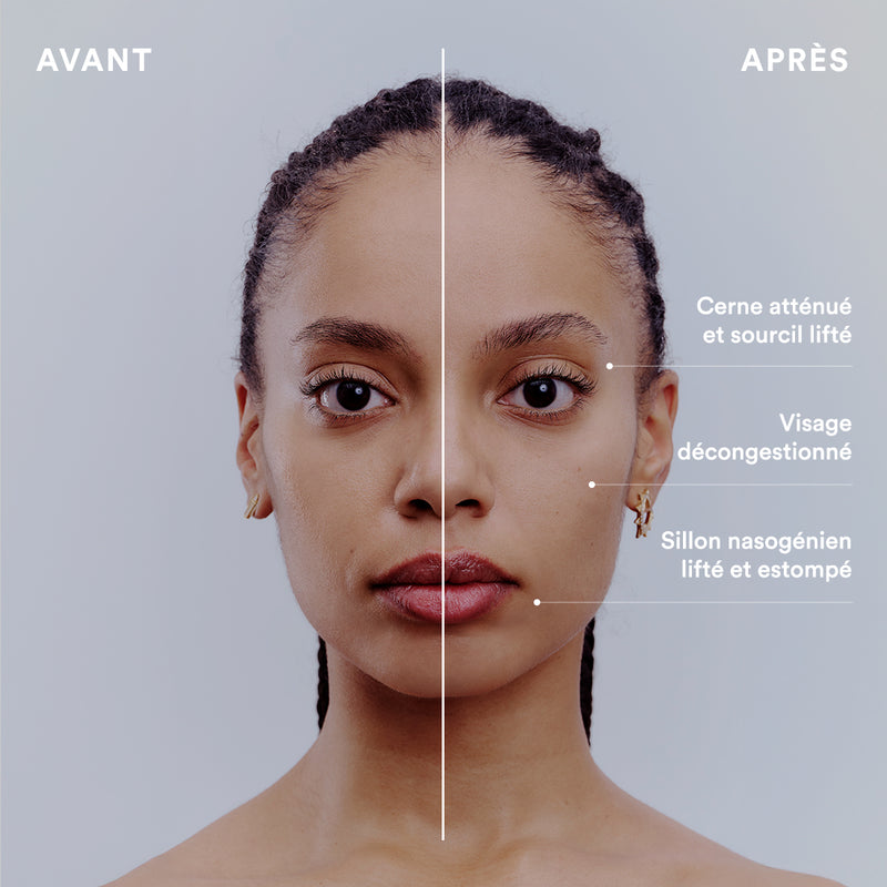 Résultats Brosse Lymphatique